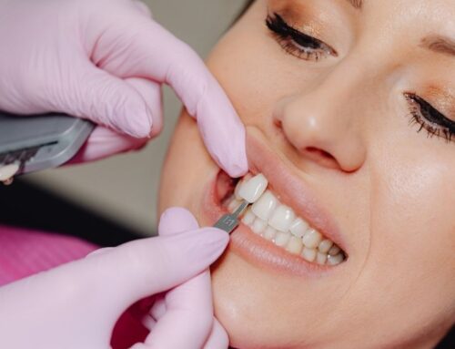 How Veneers Can Help with Common Dental Issues